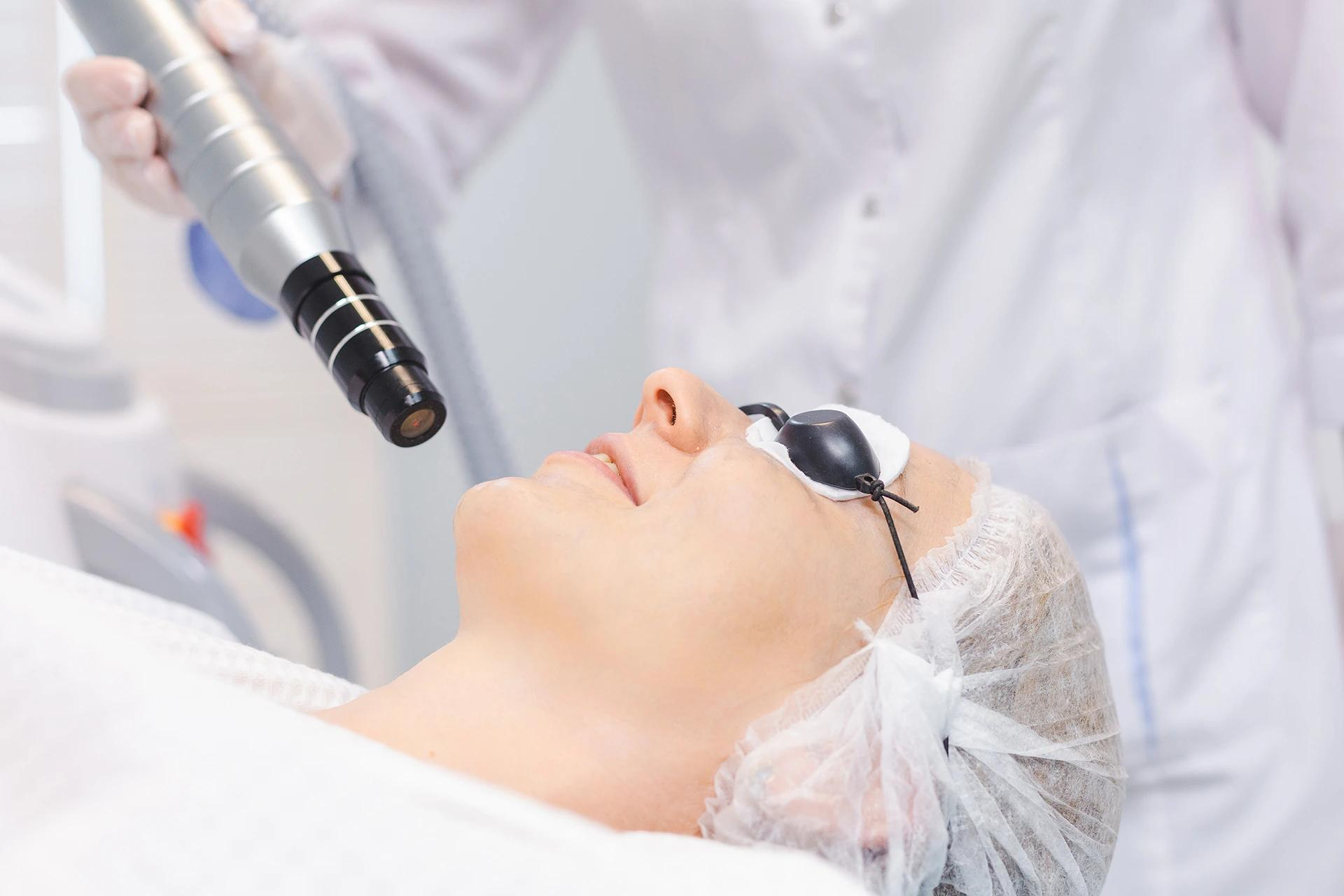 激光医疗美容